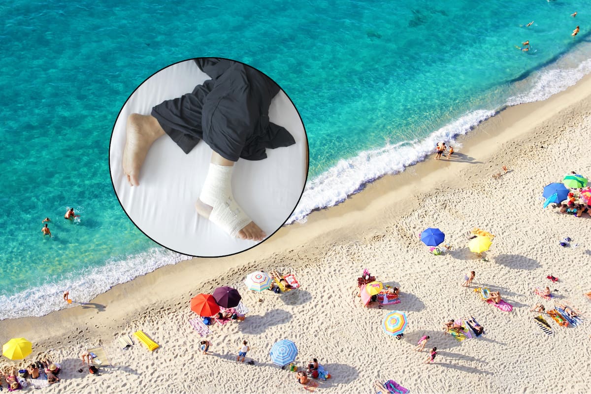 ¿Tienes una cortada y vas a la playa? Esto recomiendan los CDC para evitar una infección por la bacteria carnívora Vibrio vulnificus