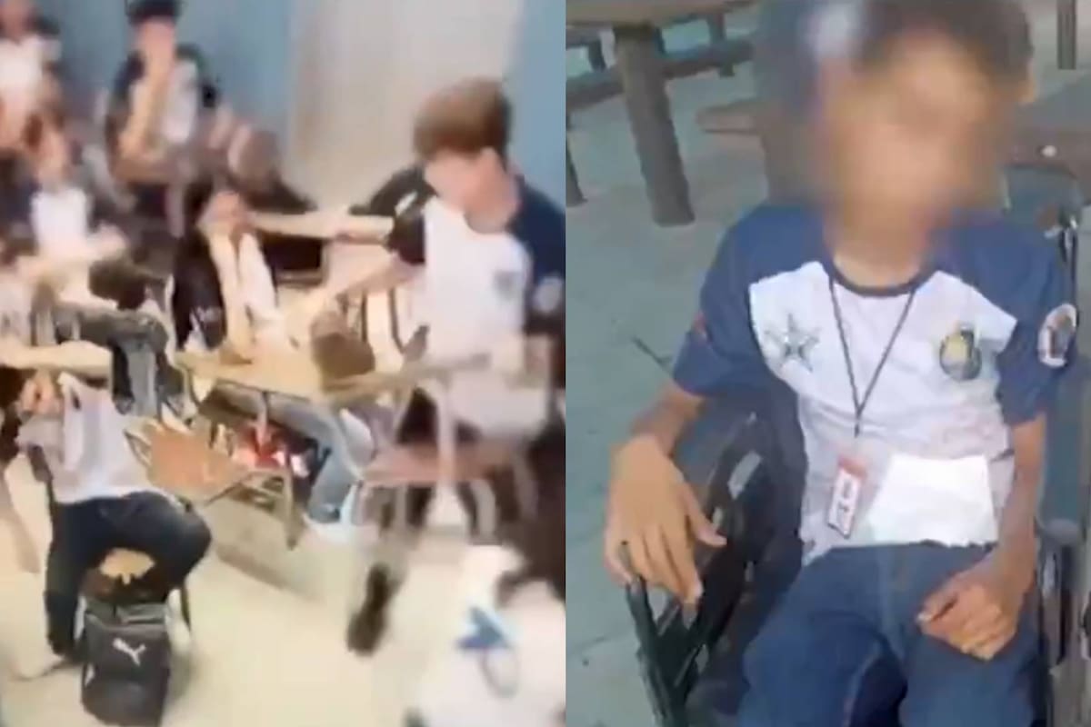 Alumno en Nuevo León es golpeado con un pupitre en su cabeza de forma accidental, pero su madre denuncia que hubo negligencia escolar al no actuar a tiempo y llevarlo a urgencias de forma inmediata