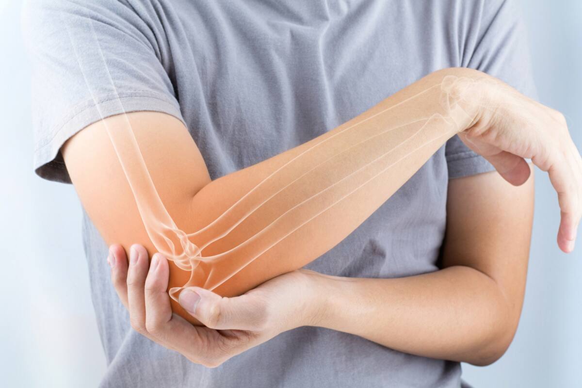 Osteoporosis y cómo evitar las fracturas