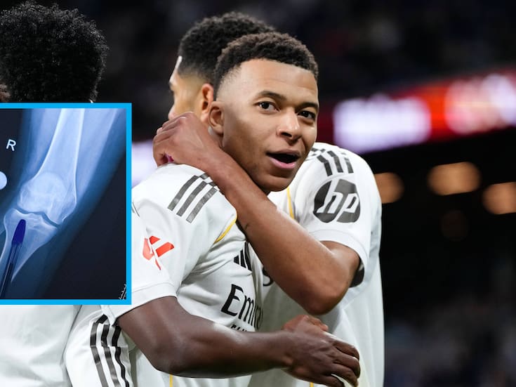 ¡Escándalo en España! Los médicos del Real Madrid se equivocaron de rodilla en el diagnóstico de Kylian Mbappé y lo hicieron jugar tres partidos con una lesión