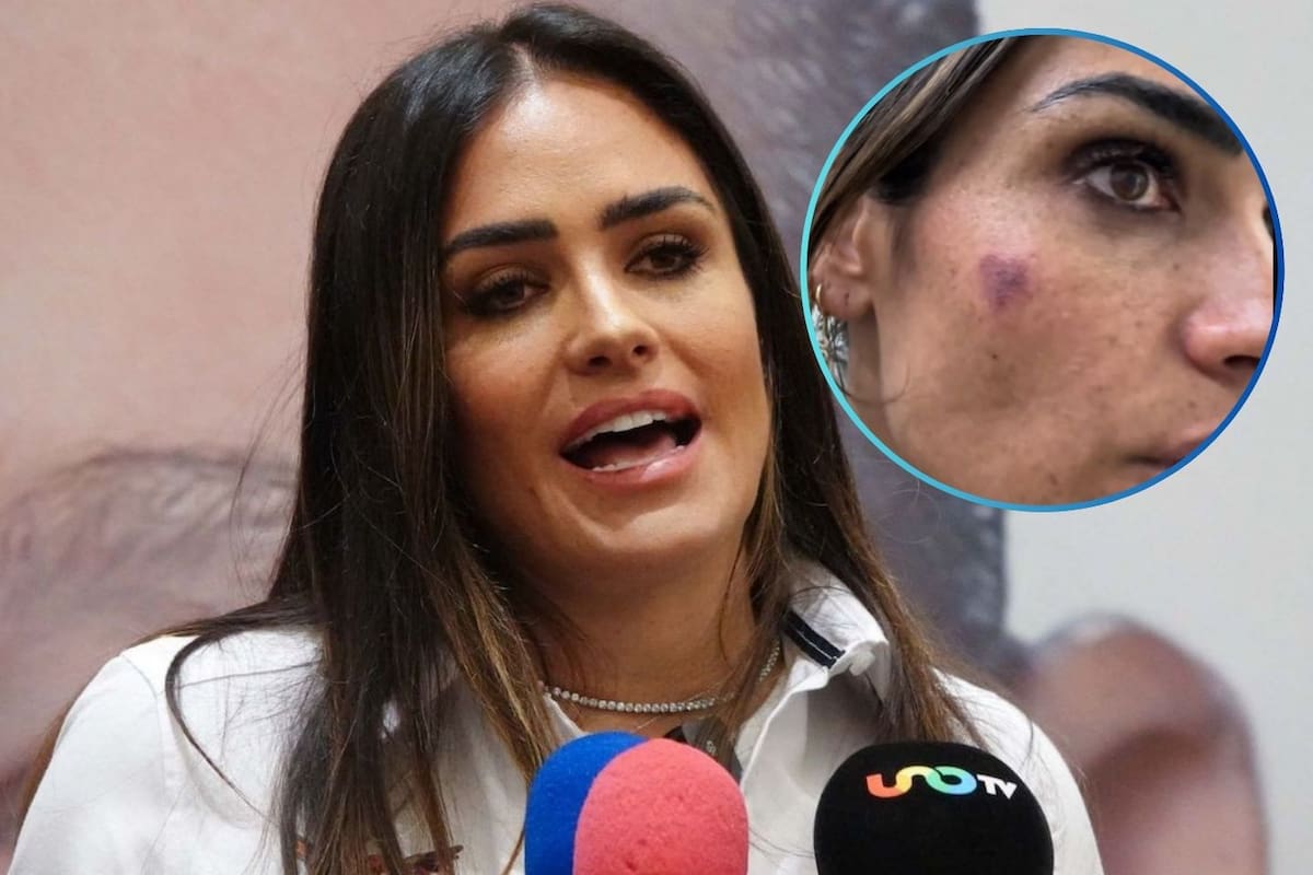 VIDEO: Alessandra Rojo de la Vega denuncia agresión física durante operativo contra ambulantaje en San Cosme