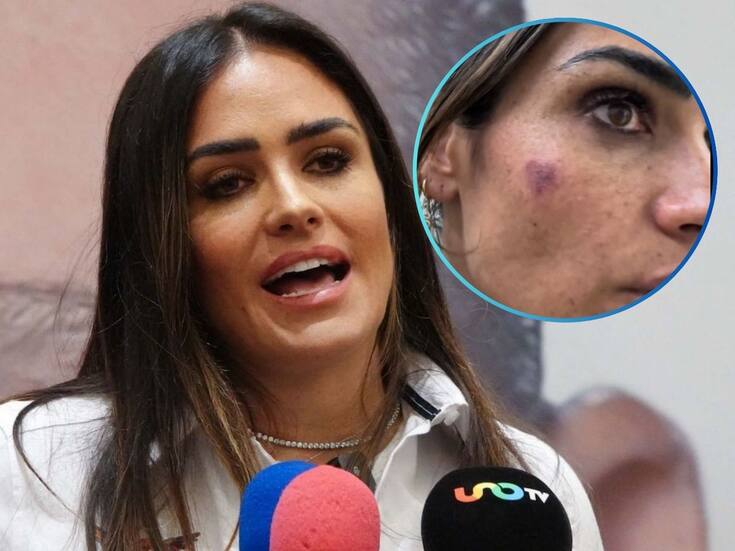 VIDEO: Alessandra Rojo de la Vega denuncia agresión física durante operativo contra ambulantaje en San Cosme