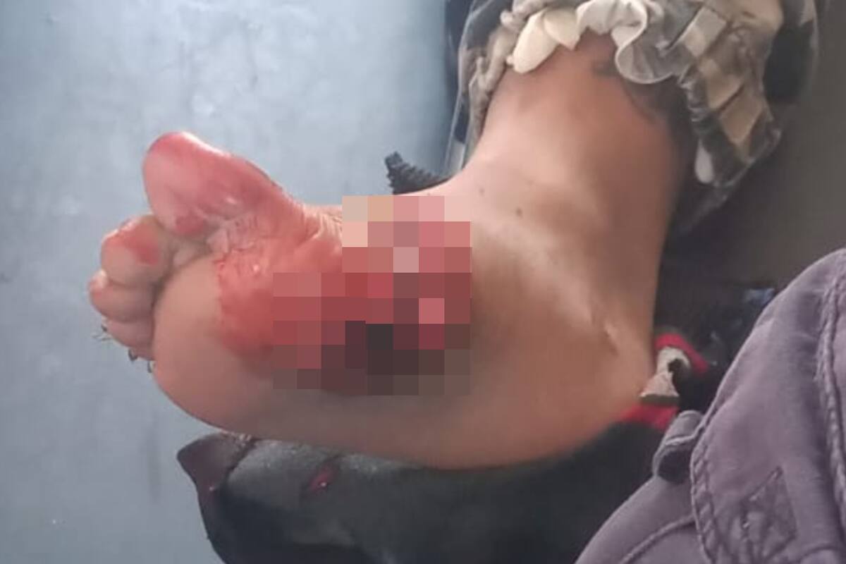 Se dispara por accidente miembro de la etnia Yaqui en bloqueo carretero