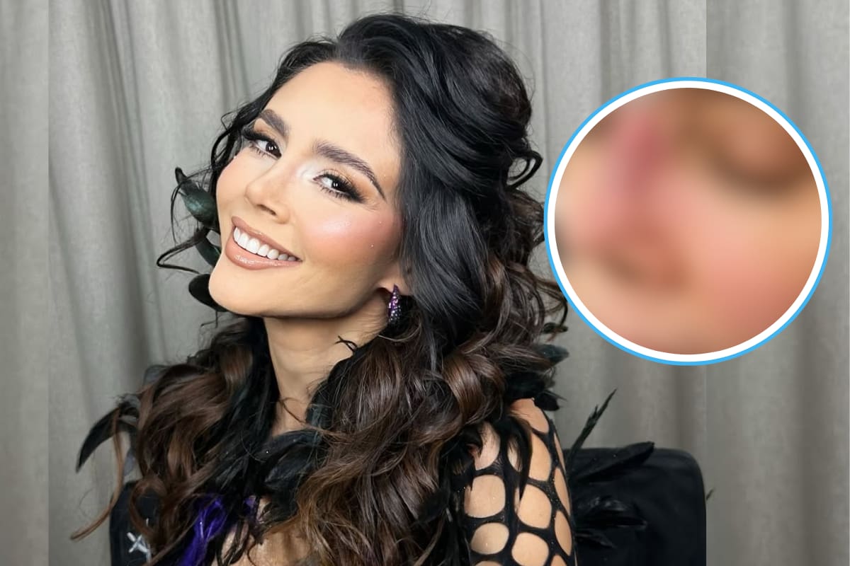 ¿Quién es Dorismar? Conductora de Televisa es desfigurada tras cirugías estéticas fallidas (FOTOS)