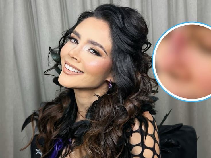 ¿Quién es Dorismar? Conductora de Televisa es desfigurada tras cirugías estéticas fallidas (FOTOS)