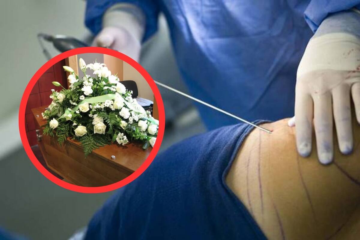 Mujer muere por negligencia médica al someterse a cirugía de liposucción