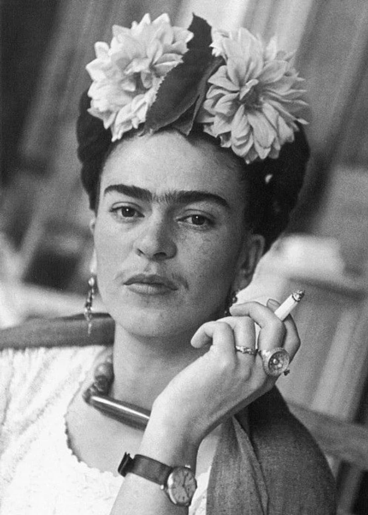 Frida Kahlo, símbolo de arte y resiliencia, ahora con un nuevo diagnóstico: síndrome de cola de caballo.