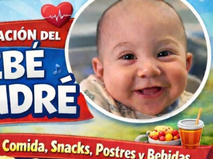 Realizarán evento con causa para apoyar cirugía del bebé André