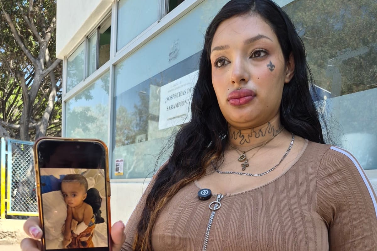 Pide mamá apoyo para conseguir un concentrador a su hijo Yahve con hidrocefalia para trasladarlo a un hospital de Sinaloa
