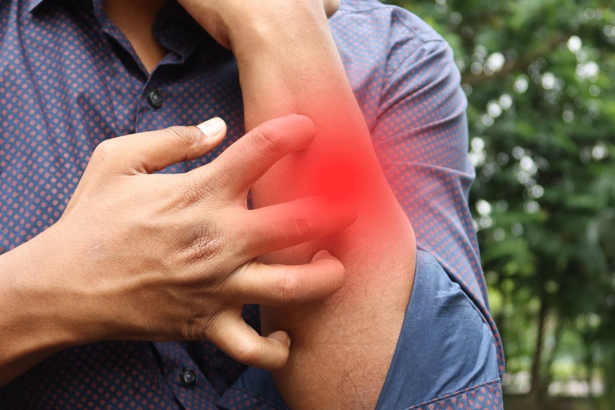 ¿Cómo saber si padeces psoriasis? Una enfermedad muy común y poco diagnosticada