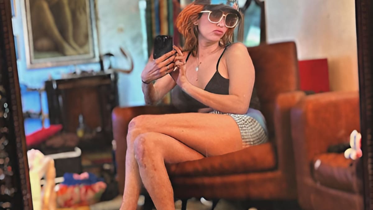 A sus 40 años, Blanes muestra signos evidentes de deterioro físico, exacerbados por el consumo de drogas | Foto: Especial