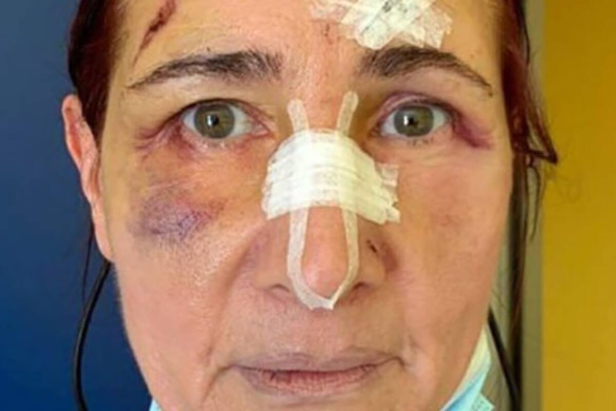 Trabajadora sanitaria, de 51 años de edad, fue brutalmente golpeada por un hombre de 36, al que le pidió que se colocara el cubrebocas