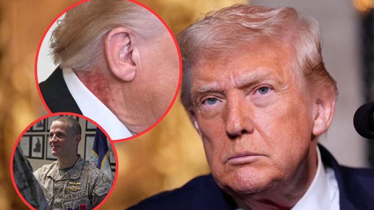 Médico de Trump asegura que el sarpullido en su cuello en su cuello es por un tratamiento preventivo y descarta afectaciones a su salud general