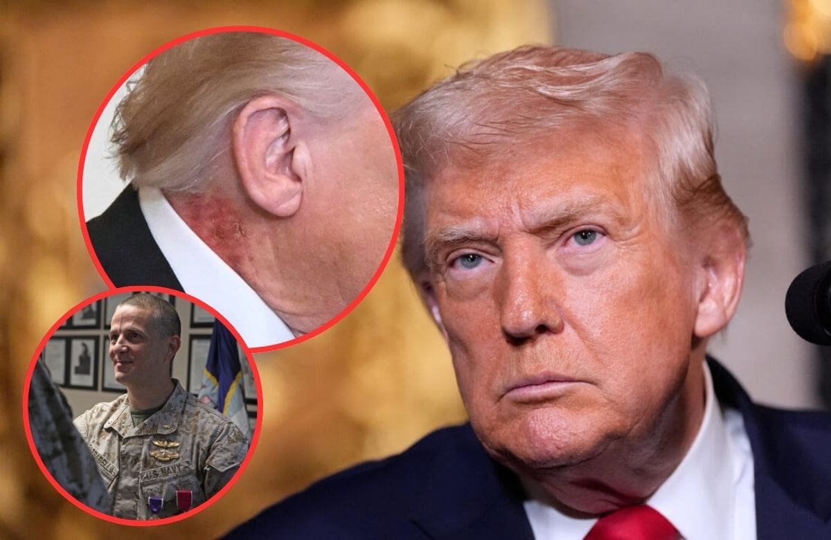 Médico de Trump asegura que el sarpullido en su cuello es por un tratamiento preventivo y descarta afectaciones a su salud general