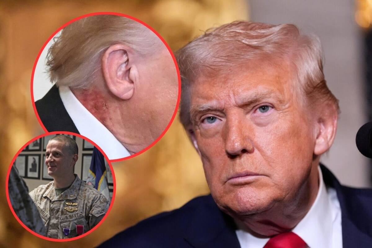 Médico de Trump asegura que el sarpullido en su cuello en su cuello es por un tratamiento preventivo y descarta afectaciones a su salud general