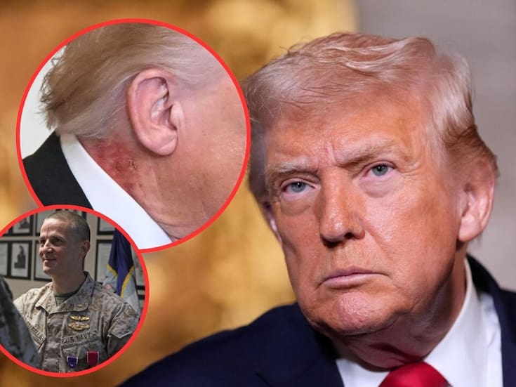 Médico de Trump asegura que el sarpullido en su cuello en su cuello es por un tratamiento preventivo y descarta afectaciones a su salud general