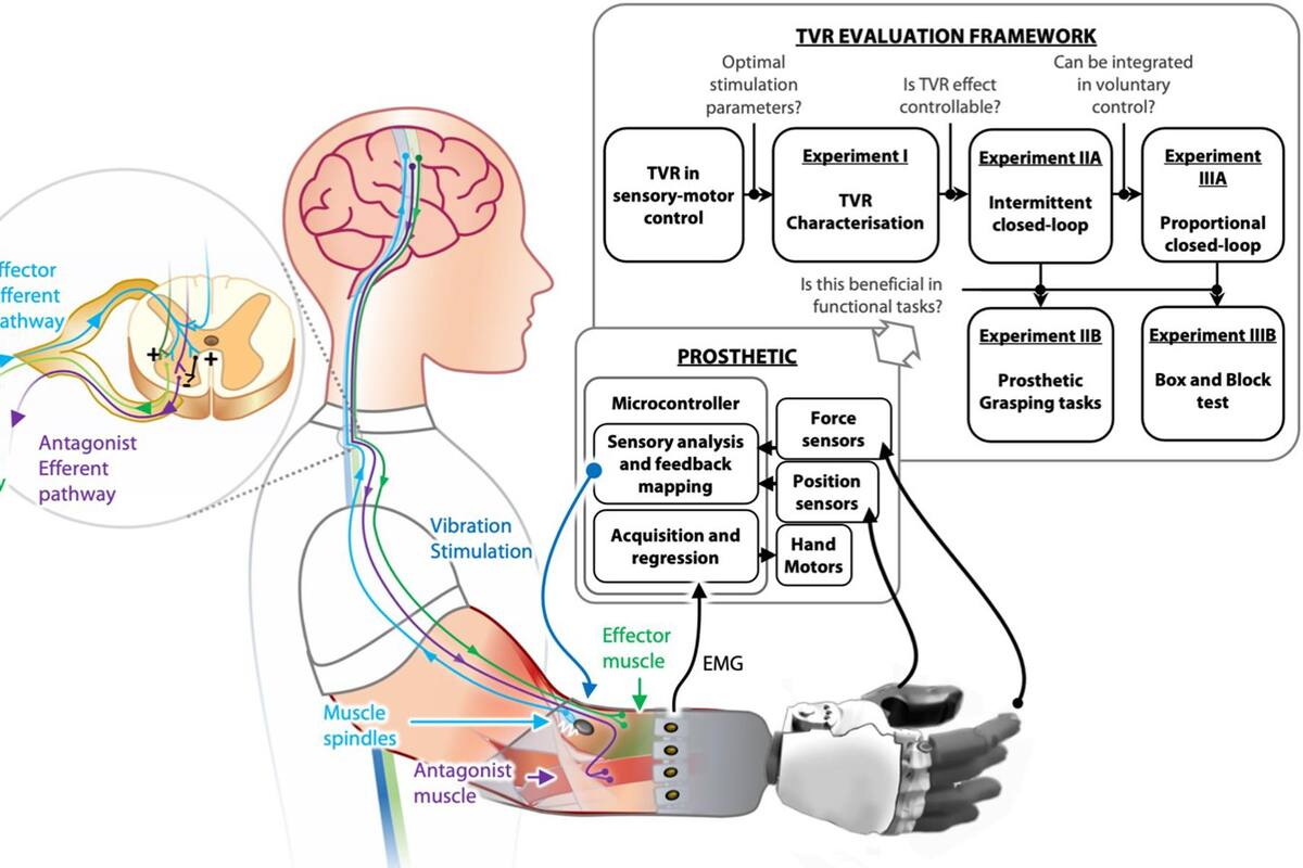 Crean dispositivo para “naturalizar” la conexión entre una persona y su prótesis