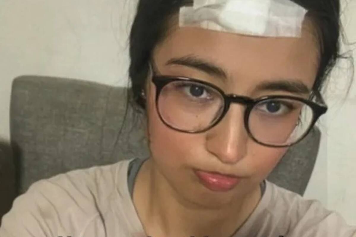 Joven de Monterrey comparte su desafortunada experiencia con un granizo en TikTok