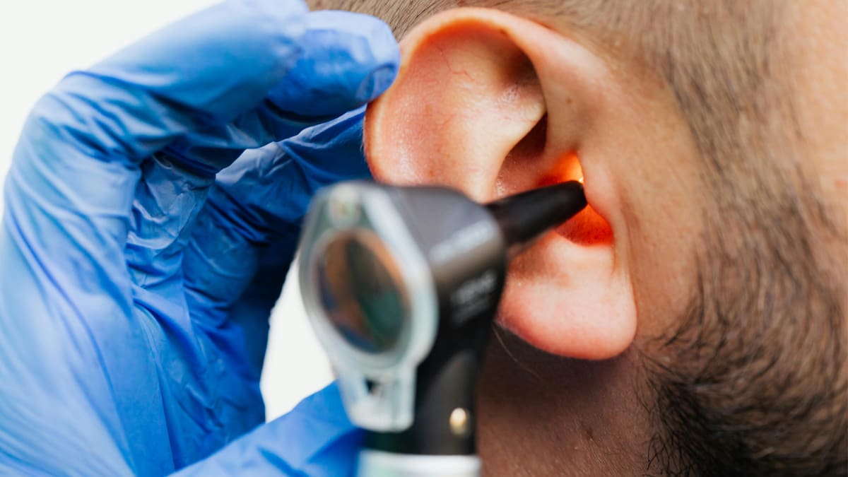 Un estudio revela que un medicamento para la disfunción eréctil podría revertir una forma genética de pérdida de audición, un hallazgo inesperado que abre nuevas vías de investigación en el oído interno