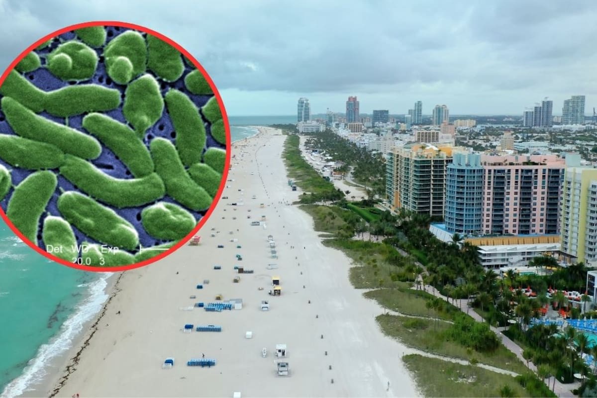 La bacteria carnívora Vibrio vulnificus ha provocado siete fallecimientos y múltiples contagios en EEUU, principalmente a través de heridas abiertas en el agua de mar y el consumo de ostras crudas