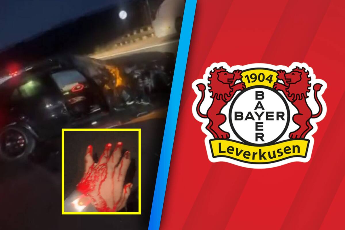 Victor Boniface del Bayer Leverkusen sufrió un accidente automovilístico y sobrevivió para contarlo