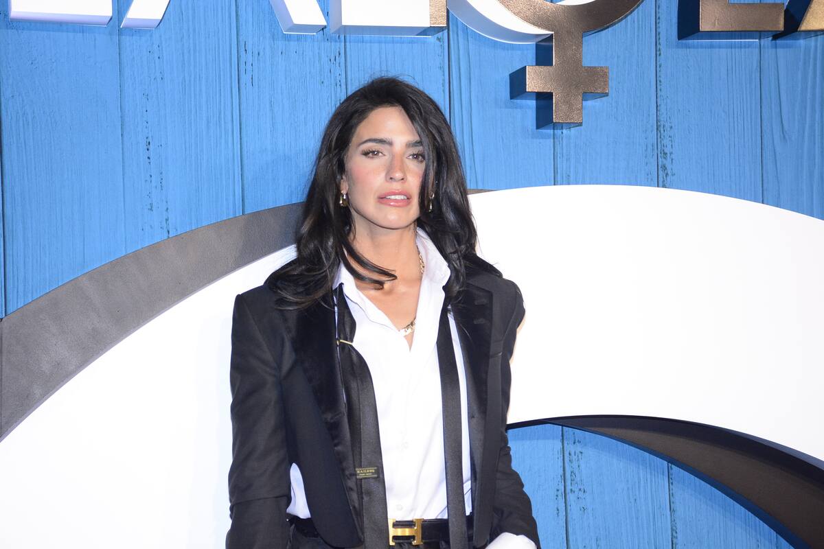 Bárbara de Regil sufre fuerte quemadura en la piel