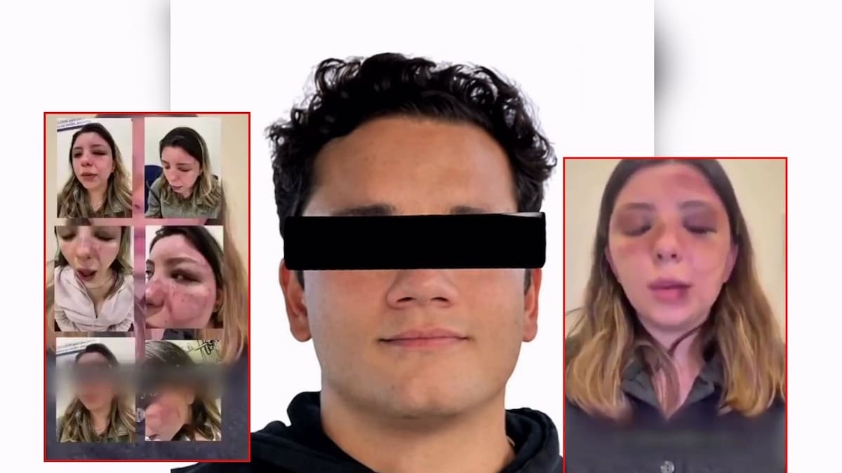 Ana Caterina Marino fue brutalmente golpeada por su exnovio dentro de su departamento; logró escapar, lo denunció ante la Fiscalía y ahora lo responsabiliza de cualquier cosa que pueda pasarle