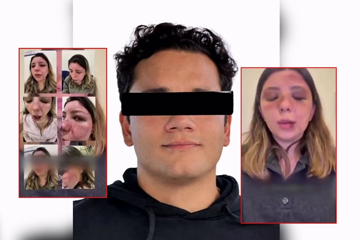 Ana Caterina Marino fue brutalmente golpeada por su exnovio dentro de su departamento; logró escapar, lo denunció ante la Fiscalía y ahora lo responsabiliza de cualquier cosa que pueda pasarle