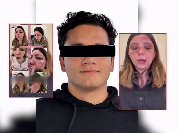 Ana Caterina Marino fue brutalmente golpeada por su exnovio dentro de su departamento; logró escapar, lo denunció ante la Fiscalía y ahora lo responsabiliza de cualquier cosa que pueda pasarle