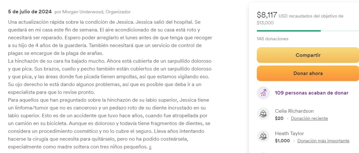 La mujer fue atacada por arañas que también se le conoce como "violinistas". Foto: Capture GoFundMe.