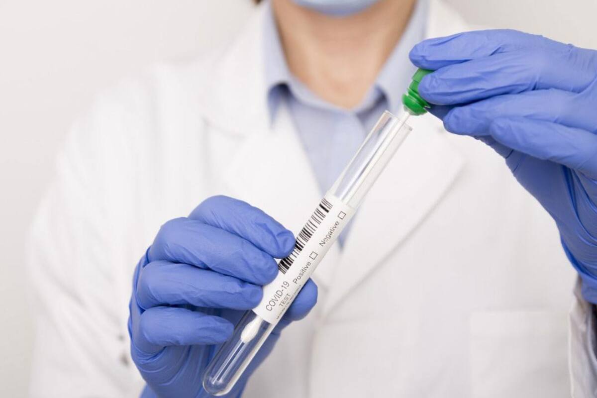 ¿Cuál es la diferencia entre el falso positivo y falso negativo en pruebas rápidas de Covid-19?