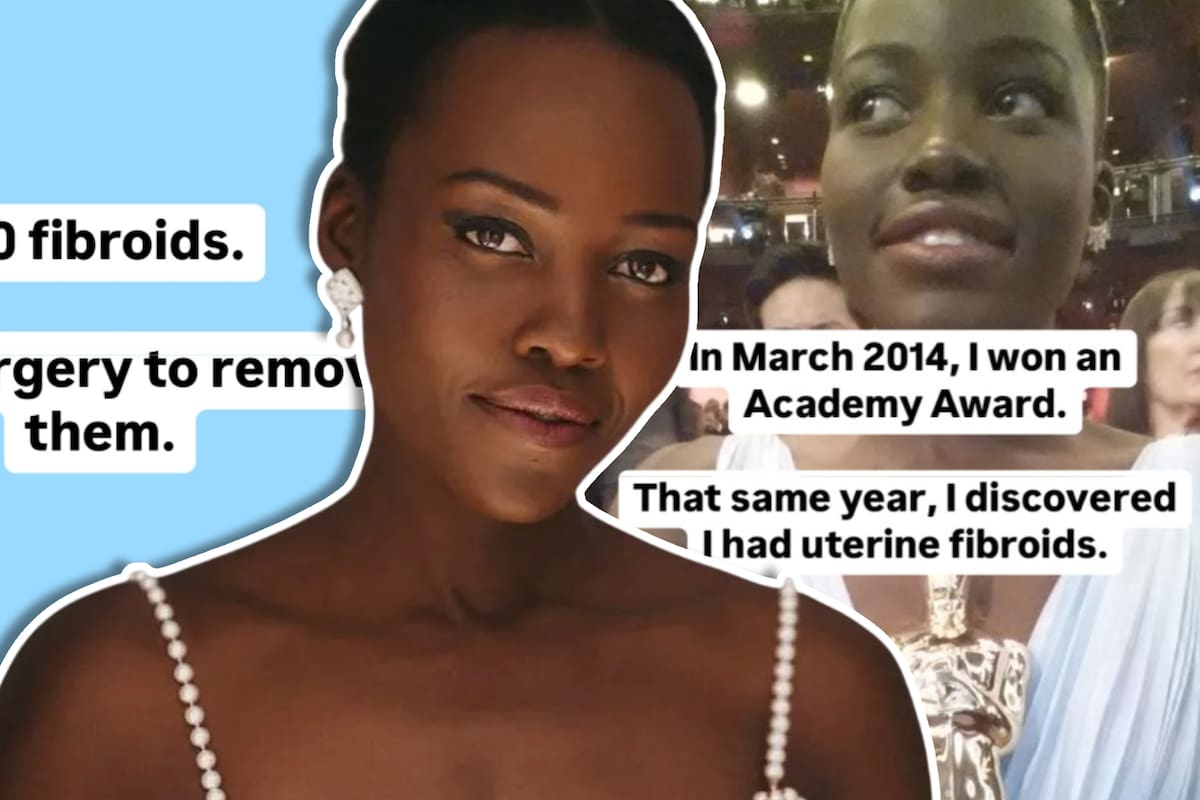 Lupita Nyong’o revela que sufre miomas uterinos desde 2014: “El dolor no es normal”