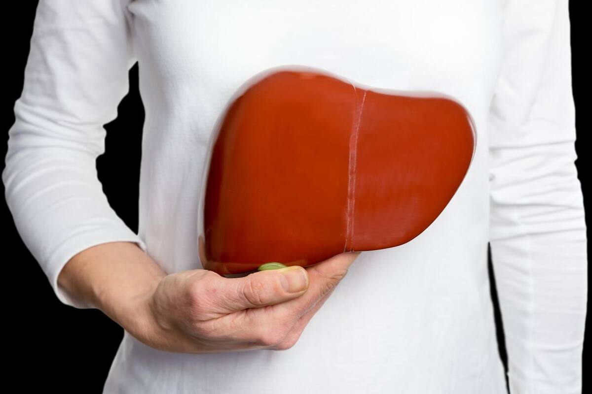 ¿Qué es la amiloidosis? Conoce más sobre esta rara enfermedad