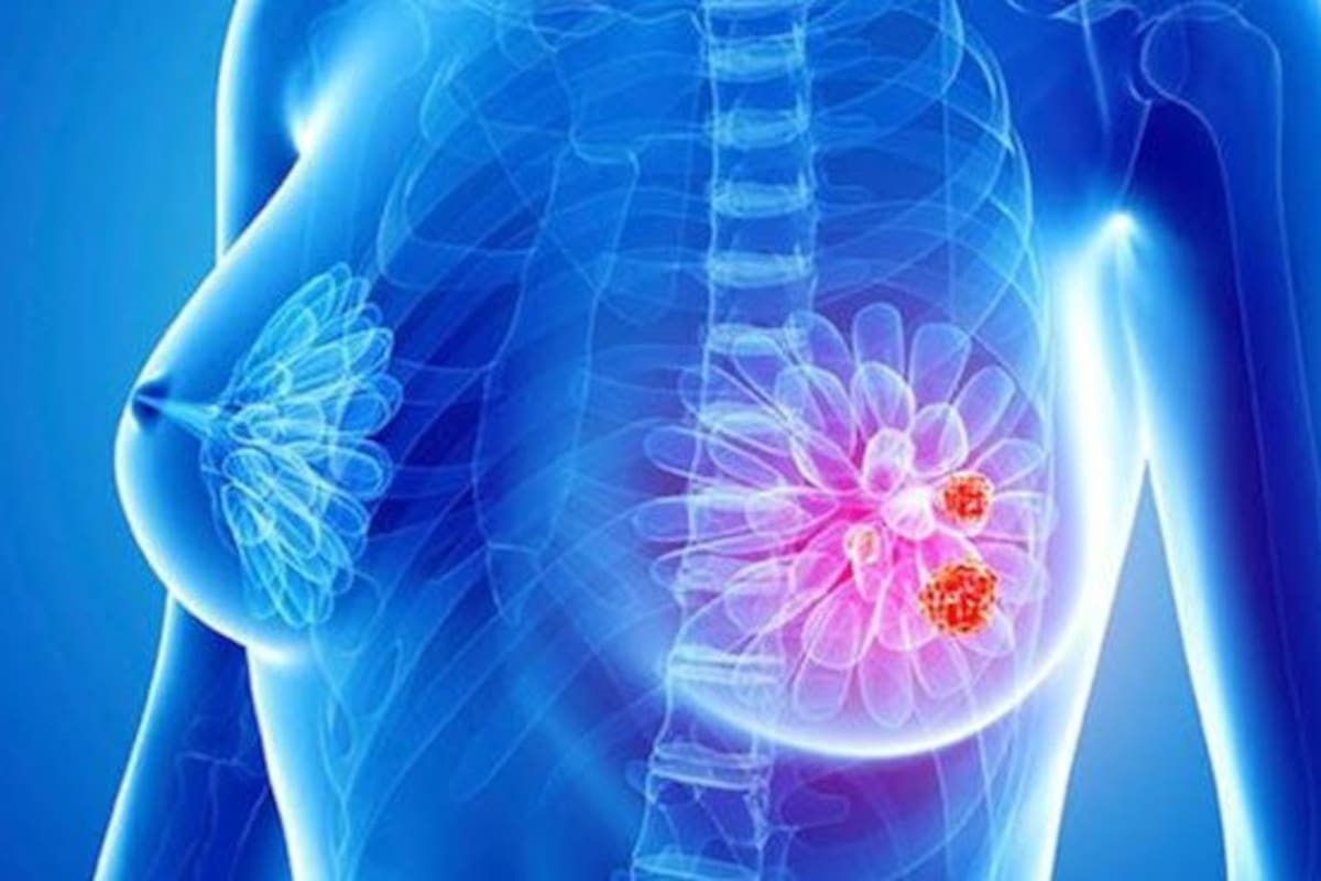Descubren célula que protege las glándulas mamarias del cáncer
