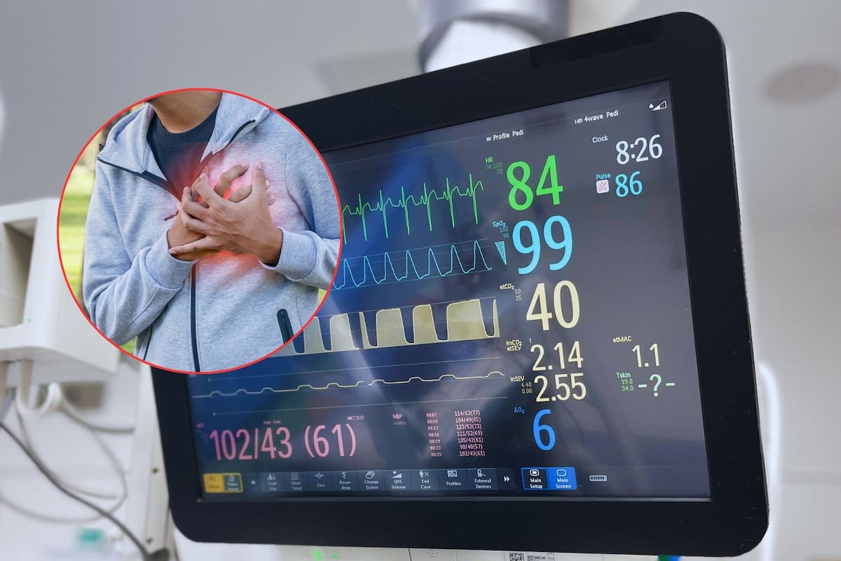 Hay una prueba médica muy precisa que puede ayudar a predecir y prevenir infartos, pero casi nadie acude a ella, aseguran médicos