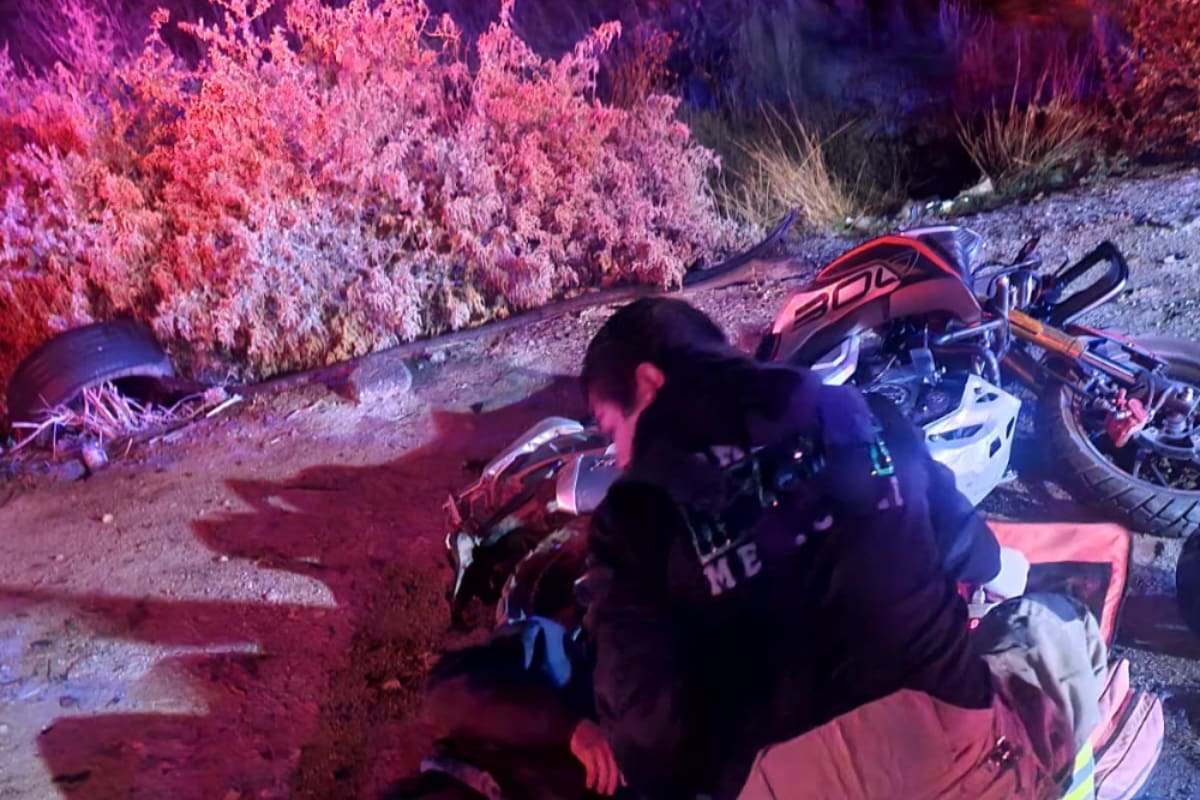 Motociclista resulta con amputación parcial de una pierna tras choque