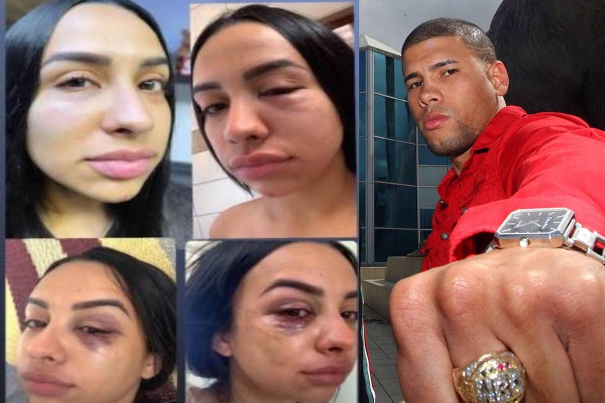 Ex pareja denuncia a ex boxeador Juanma López por violencia; es arrestado