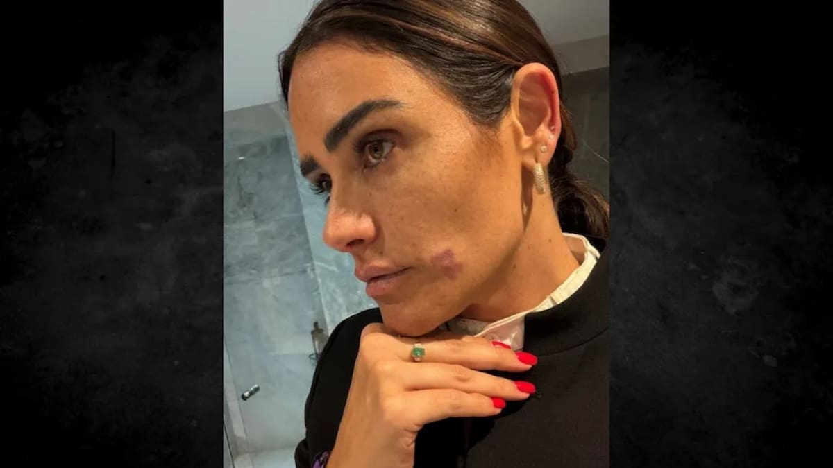 Colectivos denunciaron que un activista que documentó el operativo de Alessandra Rojo de la Vega en la Zona Rosa fue detenido por la PDI y permaneció incomunicado durante cuatro horas, según su defensa