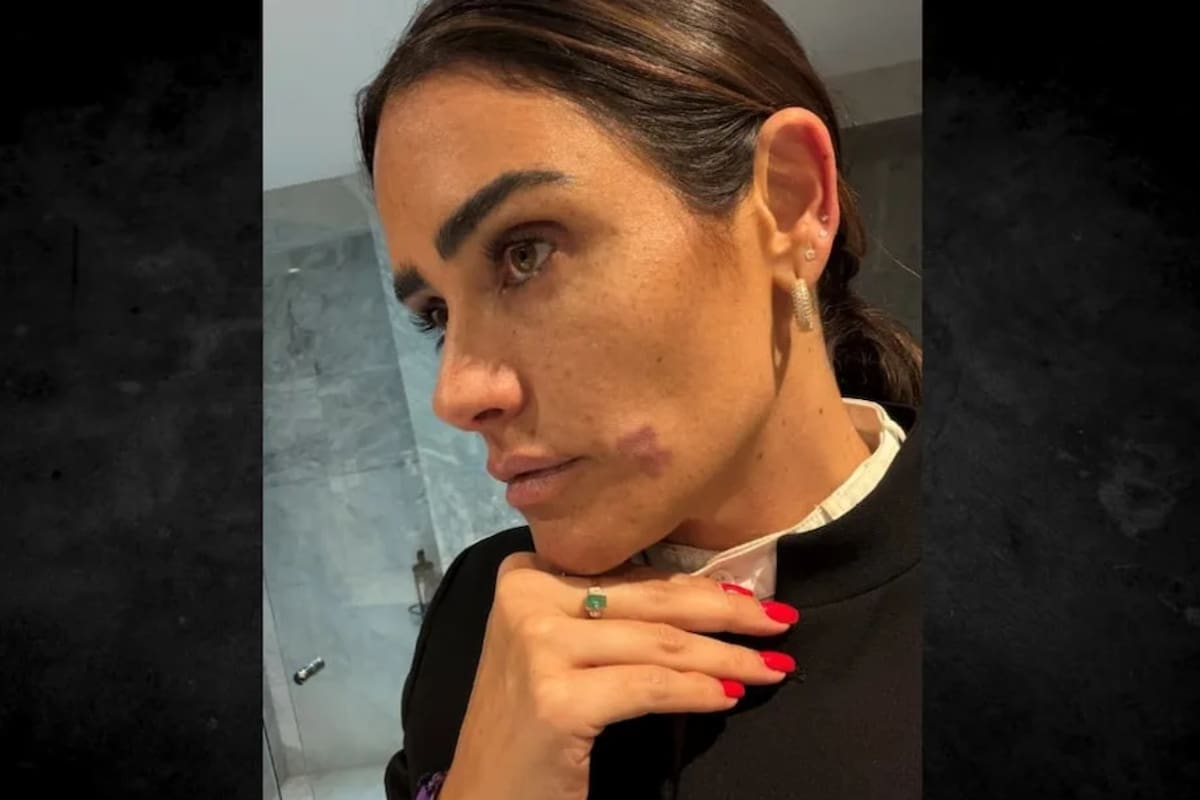 Colectivos denunciaron que un activista que documentó el operativo de Alessandra Rojo de la Vega en la Zona Rosa fue detenido por la PDI y permaneció incomunicado durante cuatro horas, según su defensa