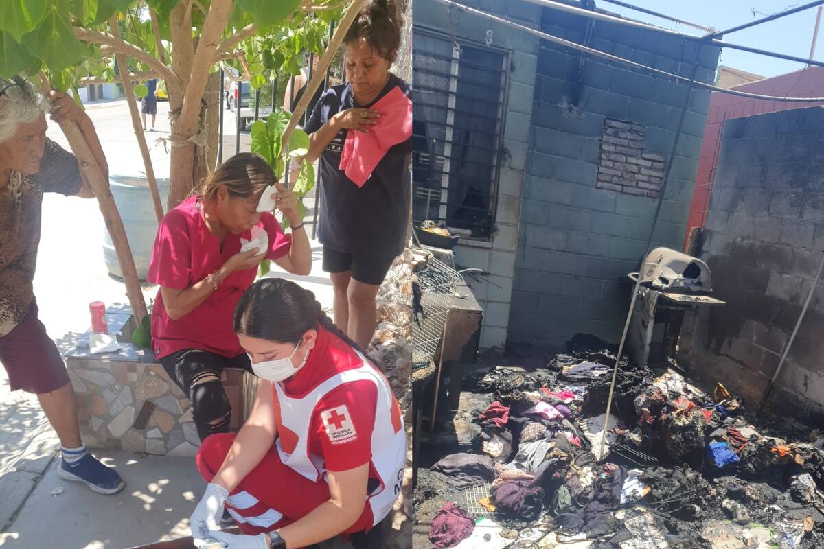 Mujer resulta lesionada en incendio