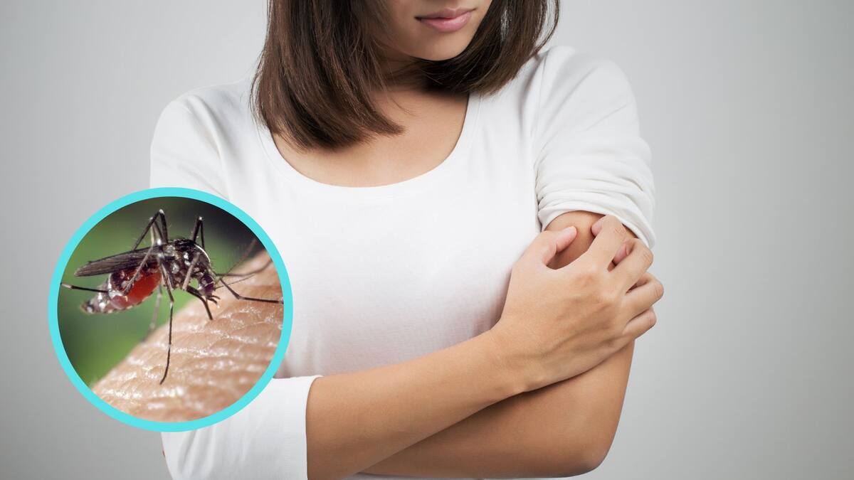 No sentir la picadura de un mosquito al instante es una estrategia evolutiva que estos insectos han desarrollado para alimentarse sin ser detectados.