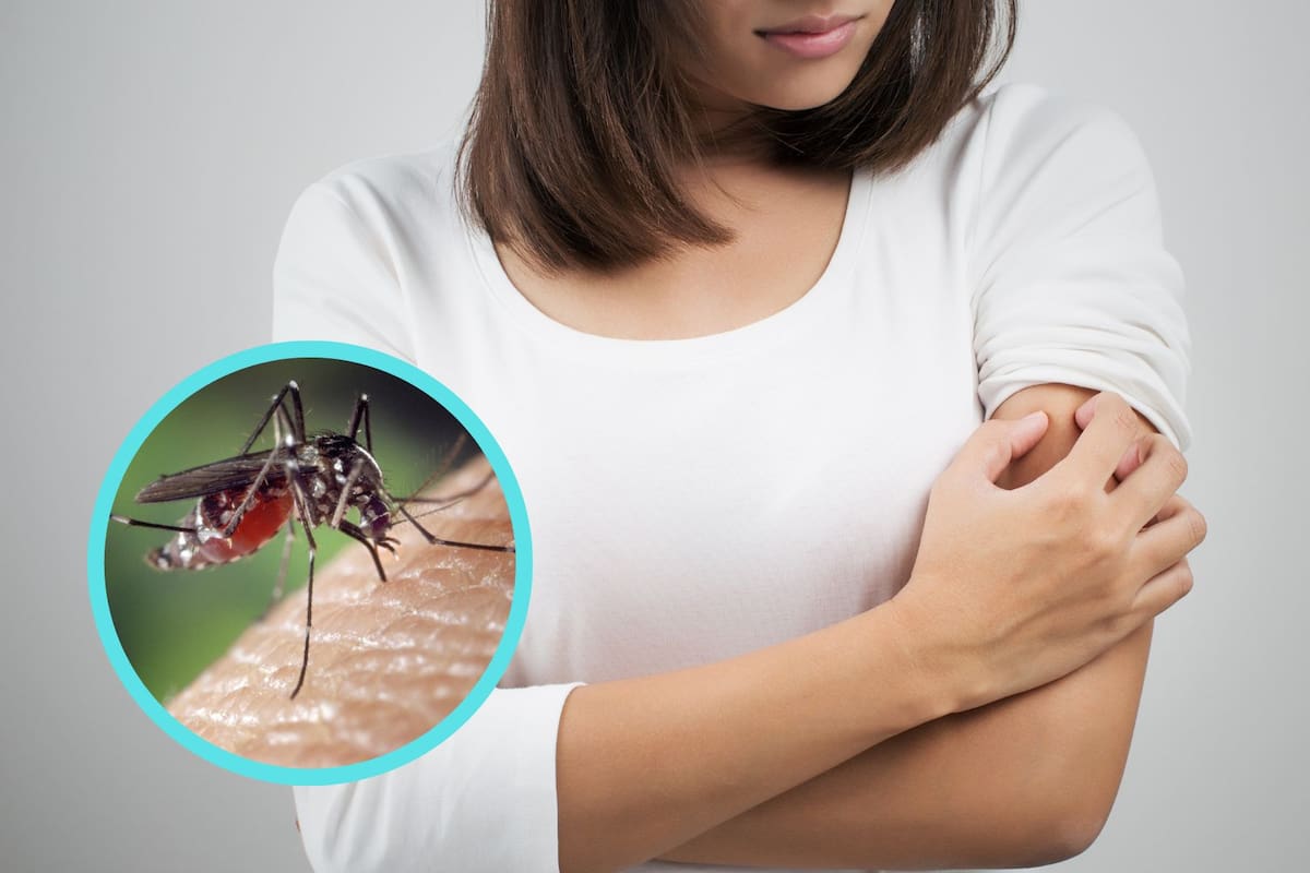¿Por qué no sientes la picadura de un mosquito hasta que te duele?