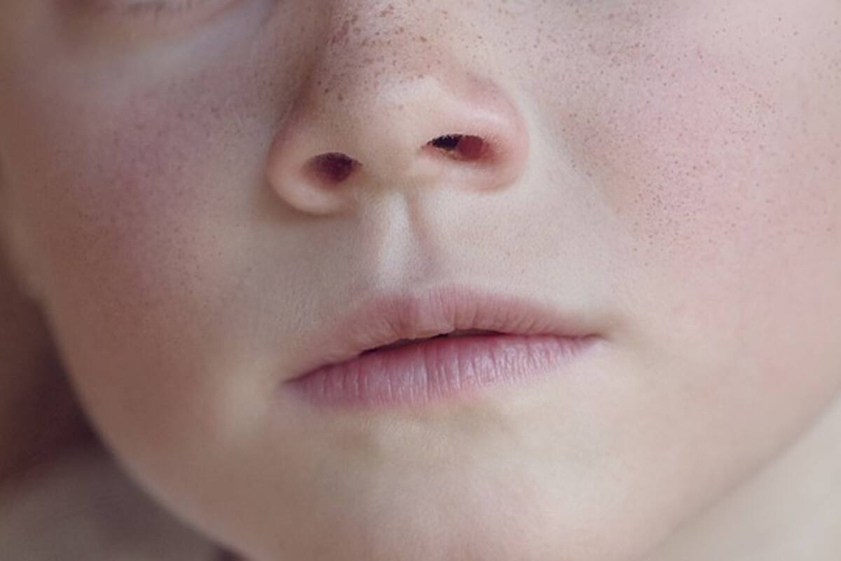 EU: Médicos retiran juguete de la nariz de menor; su madre deberá pagar 3 mil dólares