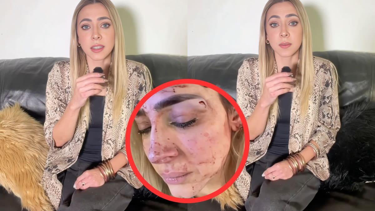 Conductora Edna Monroy muestra las lesiones por estrangulamiento tras ser agredida por su expareja, el cuñado de Jacky Bracamontes; confirma que existe una carpeta de investigación (VIDEO)