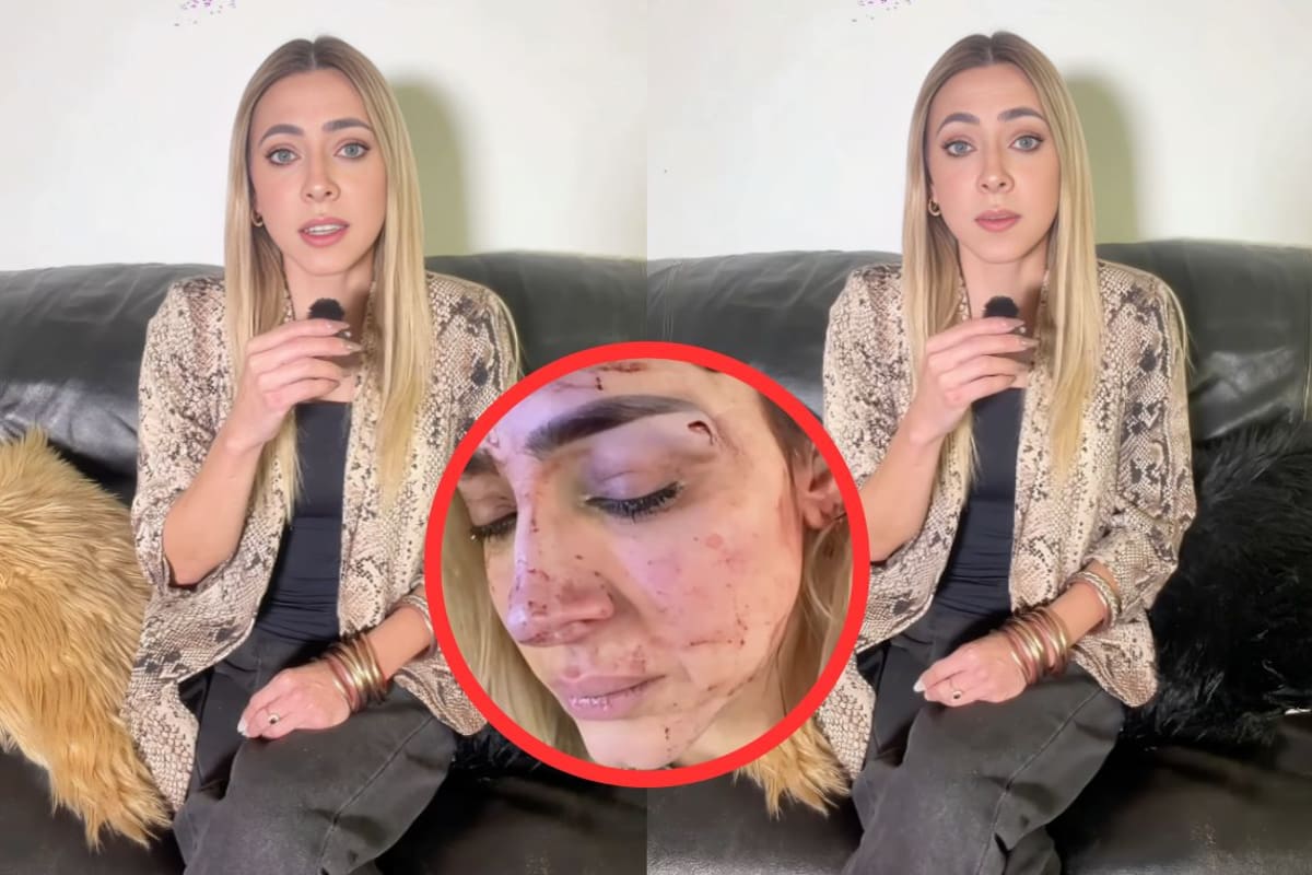 Conductora Edna Monroy muestra las lesiones por estrangulamiento tras ser agredida por su expareja, el cuñado de Jacky Bracamontes; confirma que existe una carpeta de investigación (VIDEO)