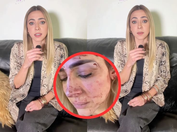 Conductora Edna Monroy muestra las lesiones por estrangulamiento tras ser agredida por su expareja, el cuñado de Jacky Bracamontes; confirma que existe una carpeta de investigación (VIDEO)