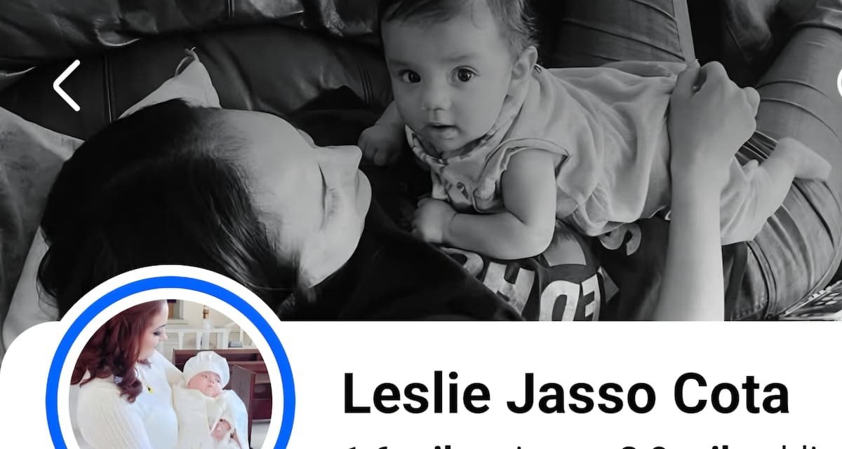 Matías presenta complicaciones derivadas del Síndrome de Down. Foto: Cortesía