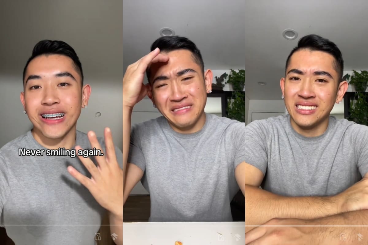 Al quitarse los brackets, este joven no pudo evitar llorar: ¡ahora cree que se ve “feo” sin ellos!