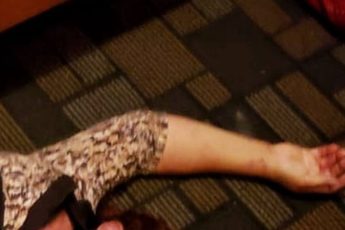 Disparo en el pecho, causa muerte de mujer en El Dorado