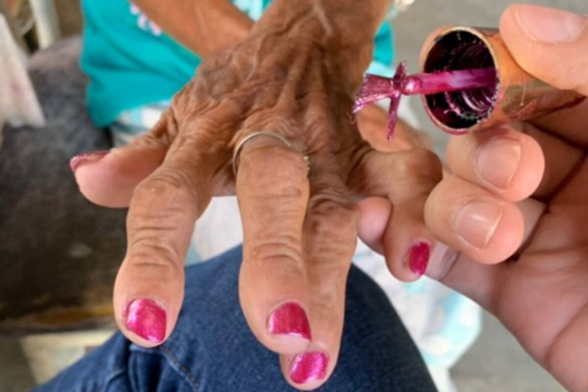 Doctor pinta uñas y prepara "sopita" a paciente de 83 años